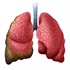 Issues Related to Mesothelioma