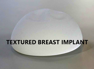 Derfor Ritual Quagmire Allergan Breast Implants Cancer | Breast Implant Recall Lawsuits