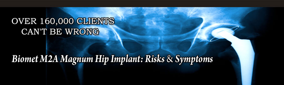 Biomet m2a Risks Symptom